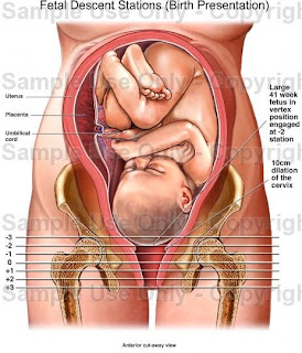 Fetal Head Engagement Chart