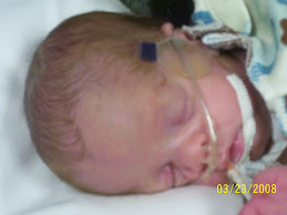 Braden