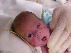 Braden