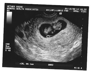 The Skene Family: Ultrasound Photos - 10 weeks