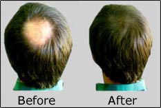 [before_after.jpg]