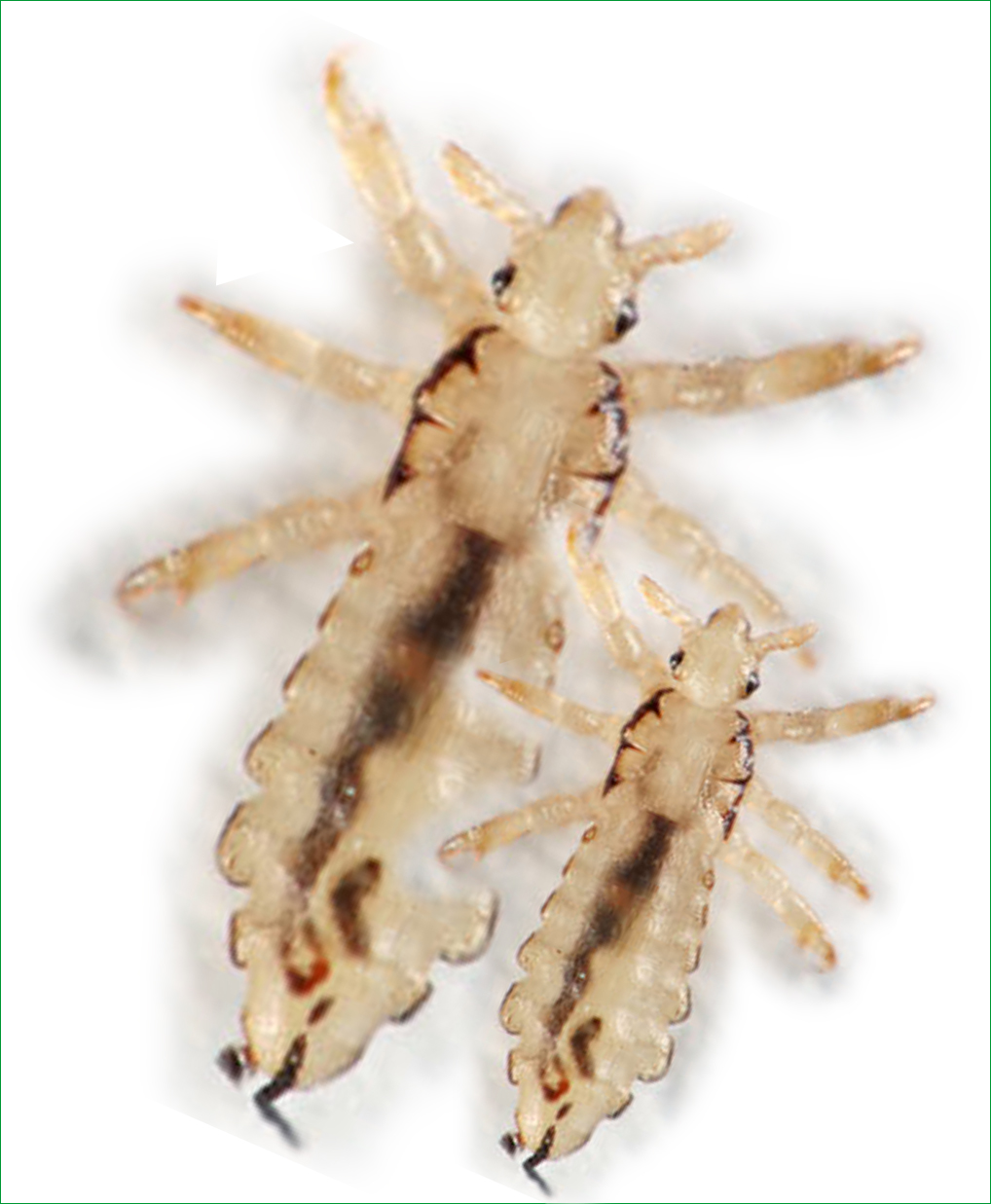 Natural Remedies For Head Lice Uk Natural Remedies For Head Lice Uk