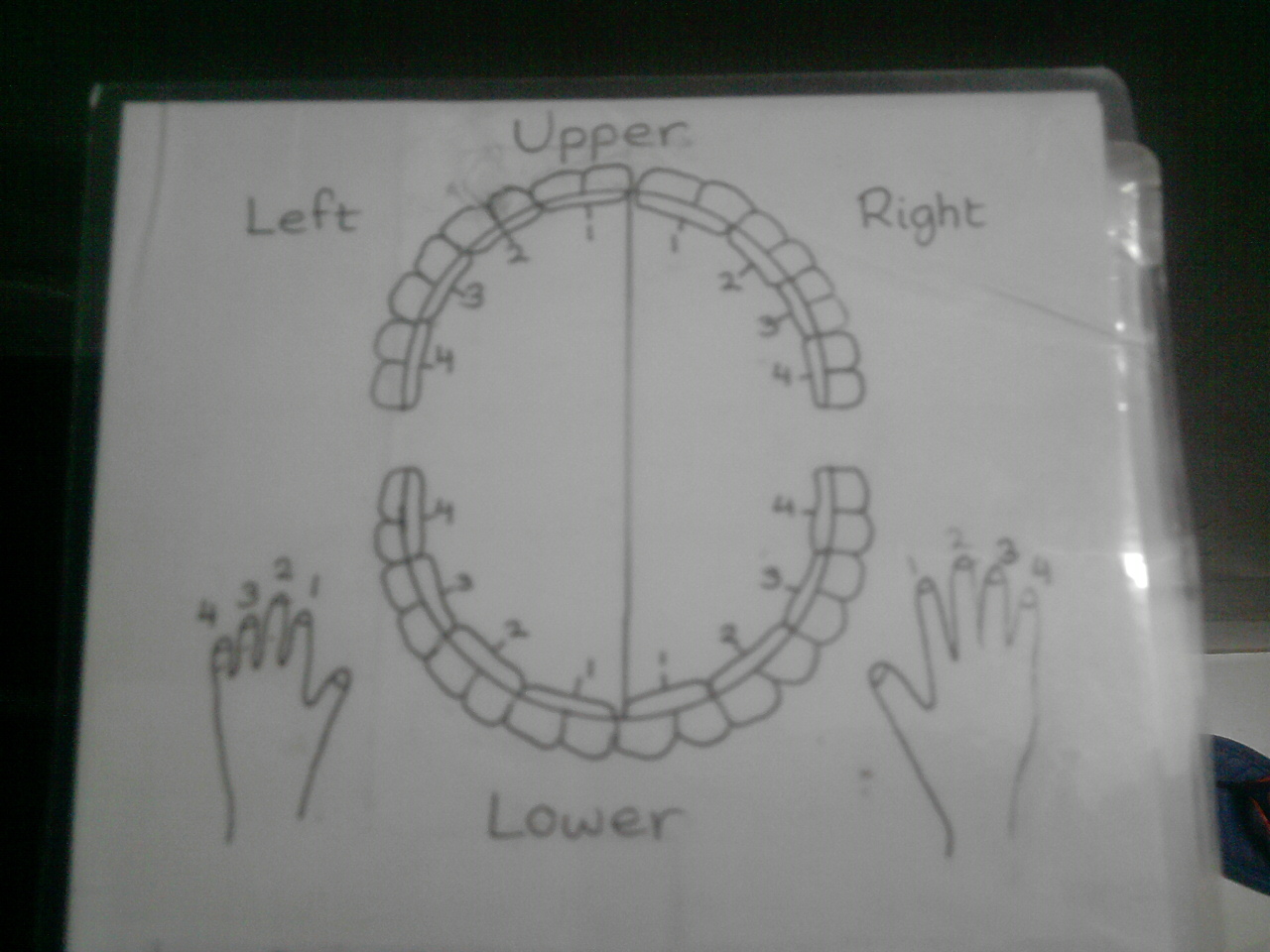 Self growth your way Acupressure therapy for toothache