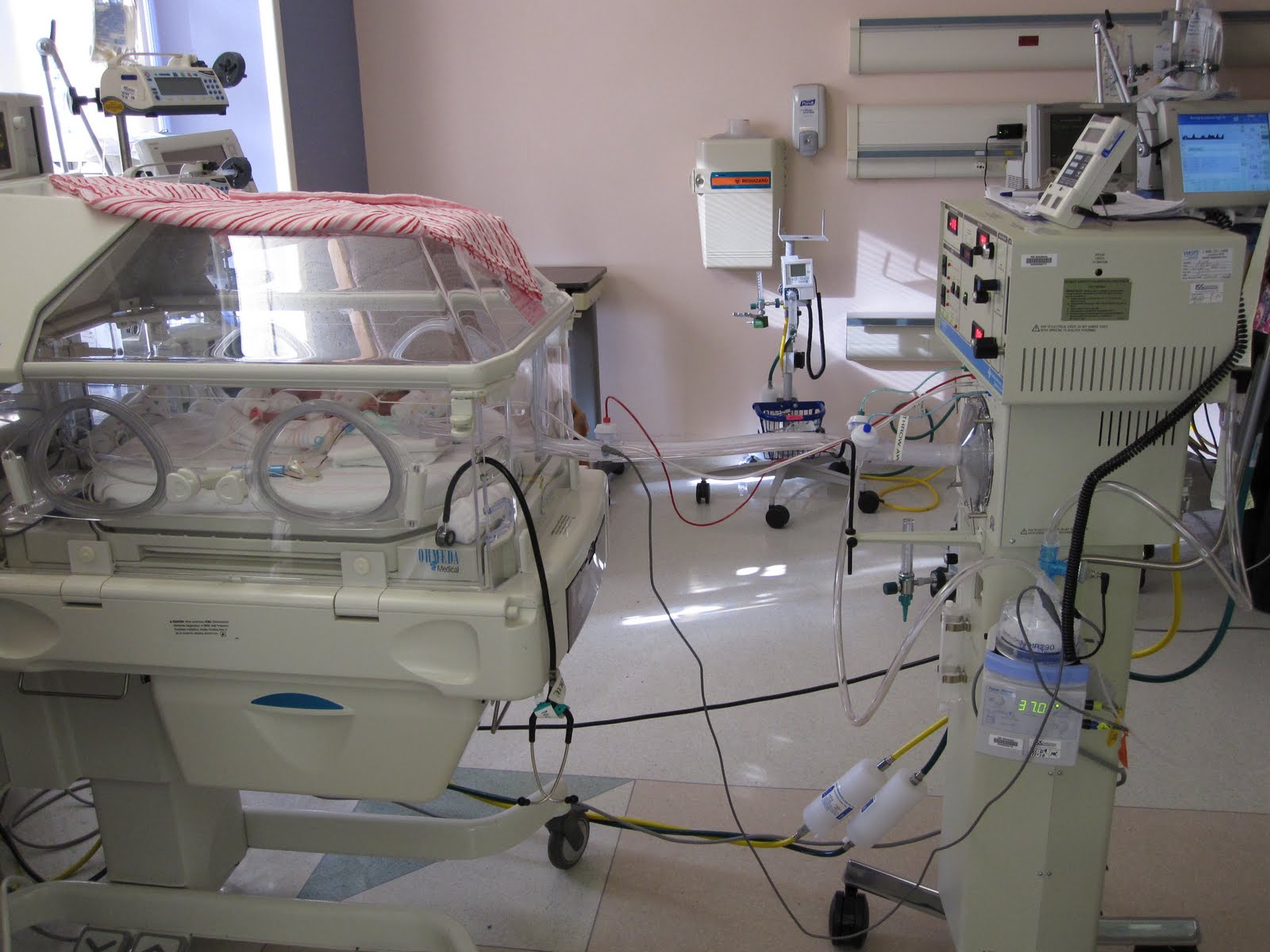 Oscillator Nicu Baby at Sharon Demeo blog