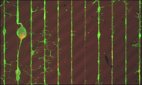 [neuronas_chips.jpg]