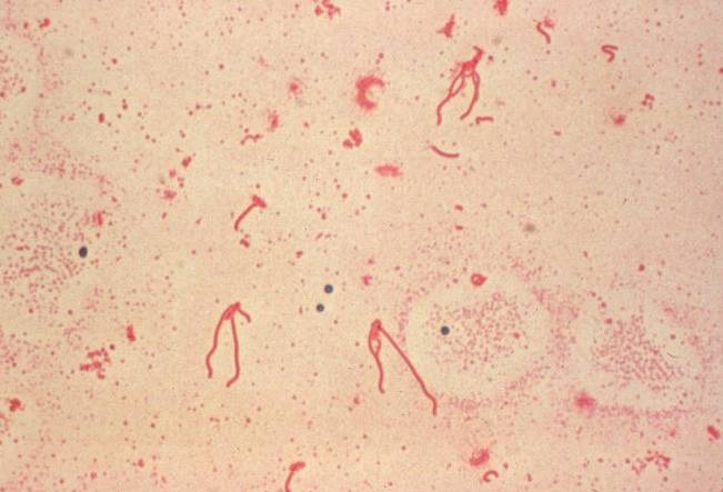 AA 上宇部こどもクリニック 食中毒：エルシニア菌