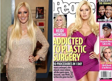 Heidi Montag, Before and After heidi montag before and after 2010. Heidi Montag, Before and After