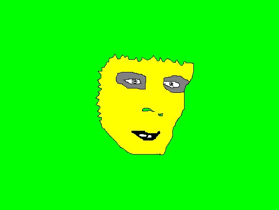 [brain+donor.bmp]