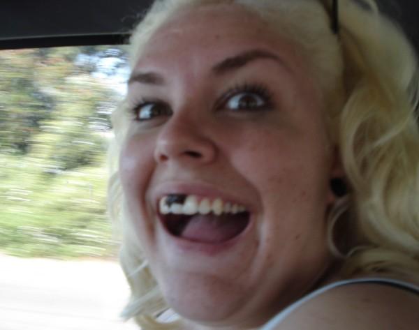 what big teeth rose szabo what big teeth rose szabo