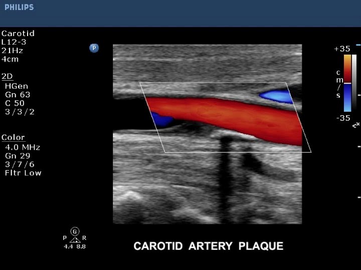 İSTANBUL DİŞ TOMOGRAFİSİ VE  ULTRASON DOPPLER MERKEZİ 0-216-5218836 RADİSTANBUL GÖRÜNTÜLEME MERKEZİ