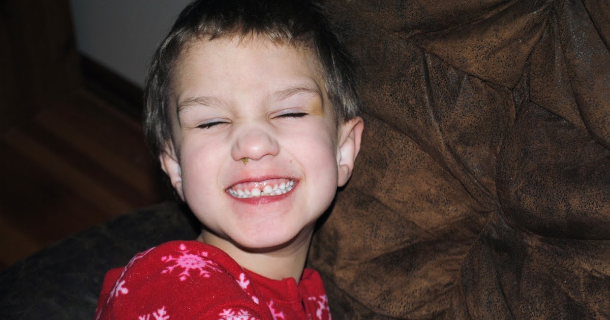 The Fragile X Files Before and After Photo Doing the Blog Hop