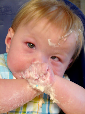 Medical Monday: Duane Syndrome Medical Monday: Duane Syndrome