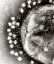 [180px-Phage.jpg]