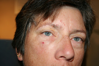 a cold, flu or pneumonia by Jennifer J. Patient Expert