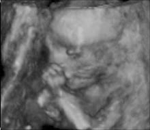 Joseph at 19 weeks