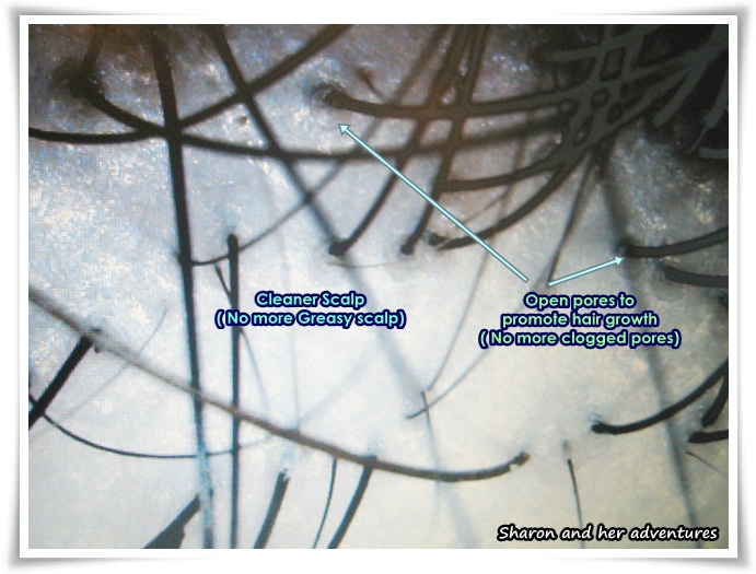 Scalp Analysis