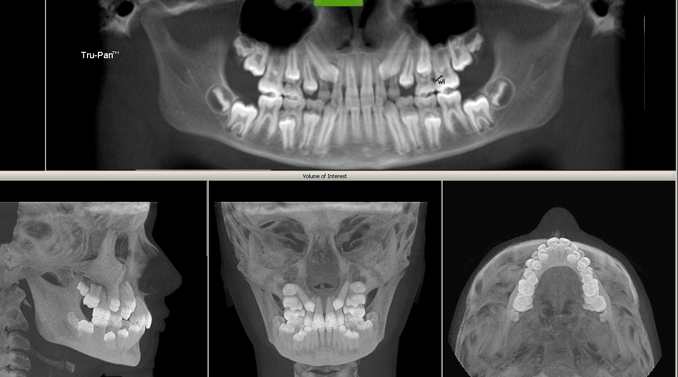Sessions Ortho Blog 3D Cone Beam iCat Xrays