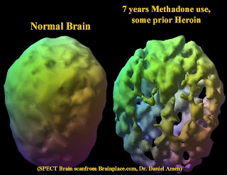 Opiates Shocking Secret What They Share With Your Brain - lg67uzq