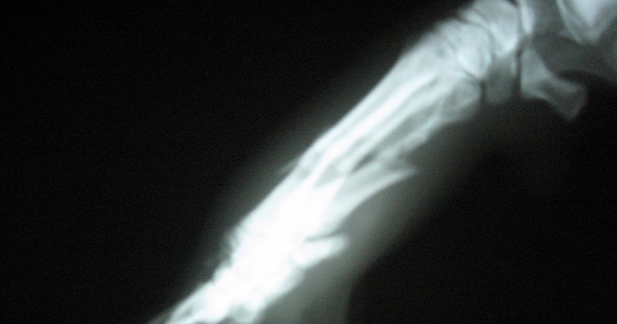 A Vet's Guide To Life XRay Week Broken Paw