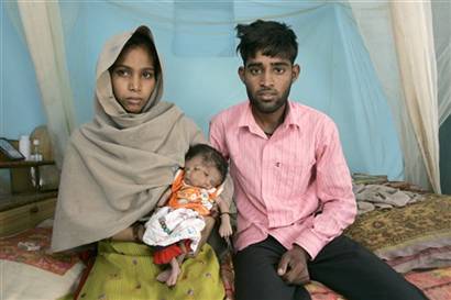 Nace niña con dos caras en la india Nace niña con dos caras en la india