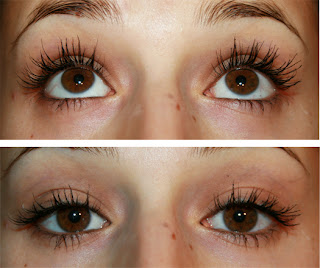 Bimatoprost Y Latanoprost Eye Lashes
