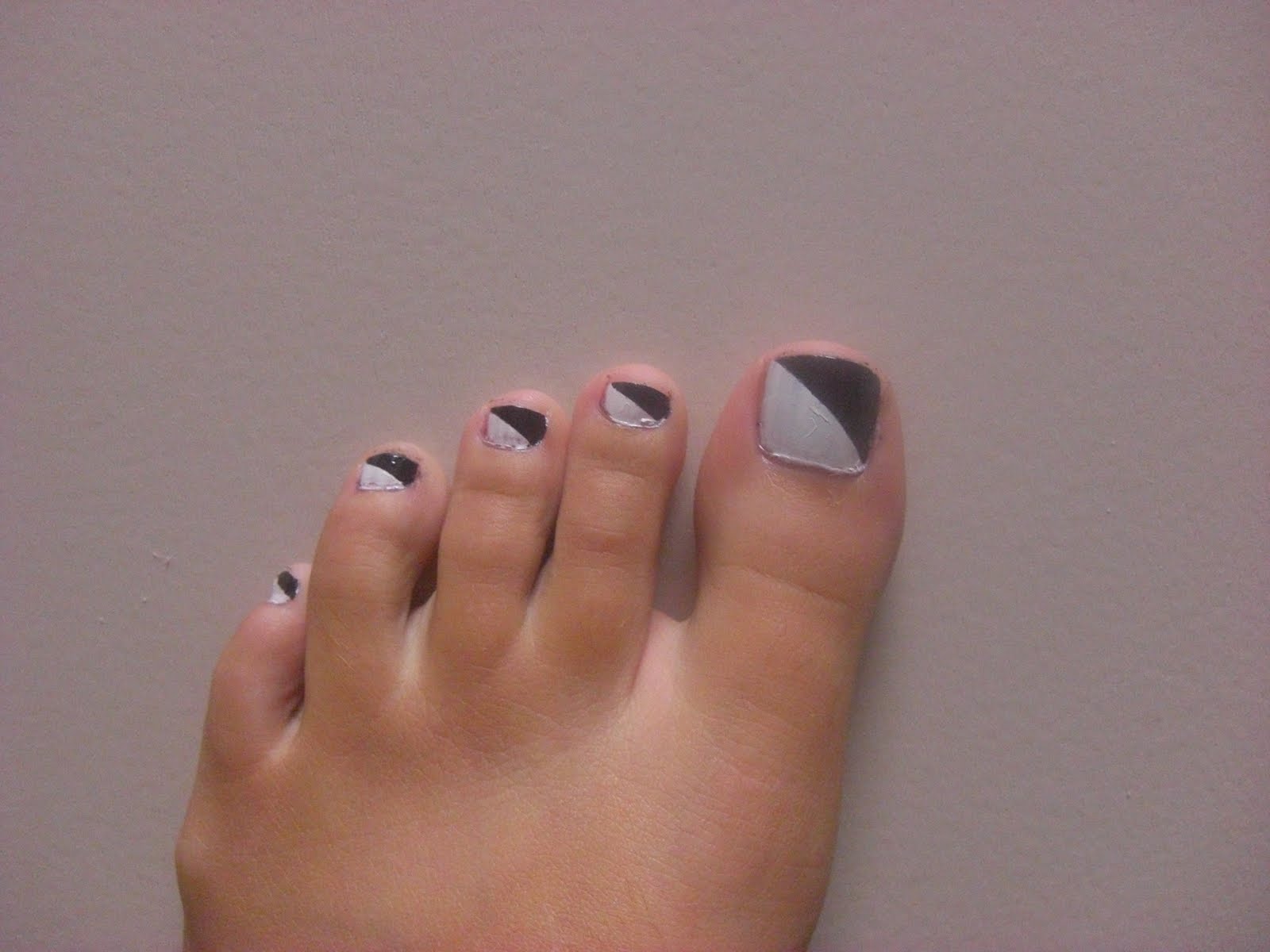 Cloudy Toenails