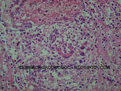 rencontre tact nancy