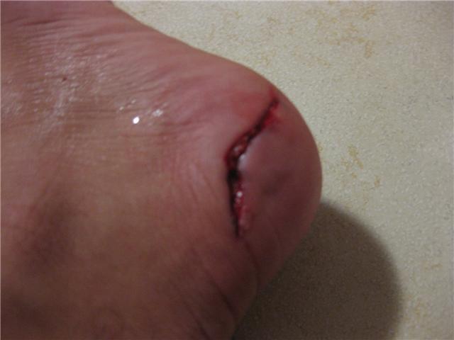 [ANKLE.jpg]