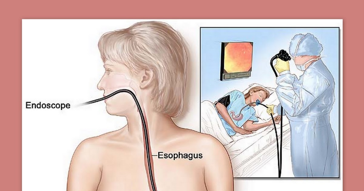 talkIsaid What is Endoscopy & Colonoscopy?