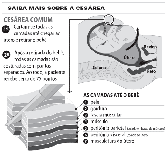 [cesaria.gif]