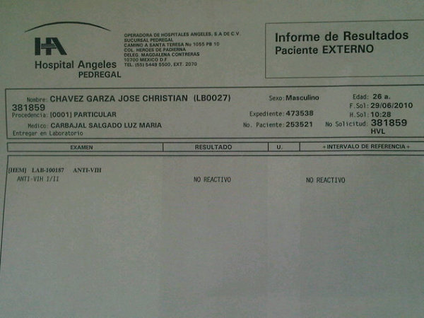 Resultado de exame hiv nao reagente