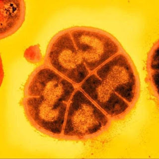 http://2.bp.blogspot.com/_ziPJWp4LX_o/S-0u8tmoORI/AAAAAAAAEd8/aVurdg6_HgU/s1600/500x_deinococcus.jpg