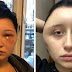 'I almost died': Young French woman disfigured by hair dye