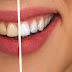 Como clarear os dentes naturalmente