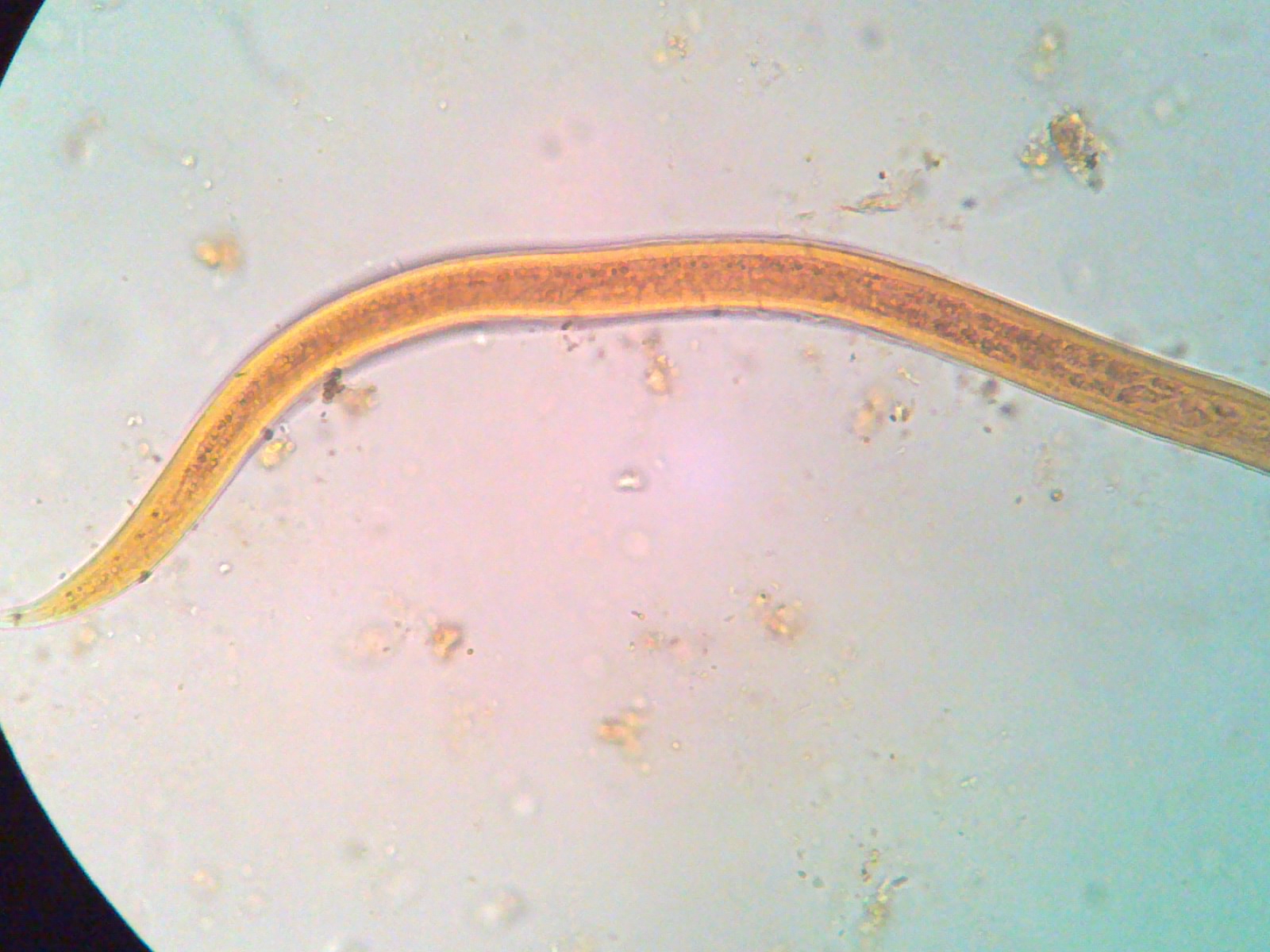 Parasitología Tecnologia Medica UST La Serena 2012: Strongyloides ...