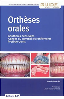 Orthèses orales 41uDtH5JneL._SX322_BO1%252C204%252C203%252C200_