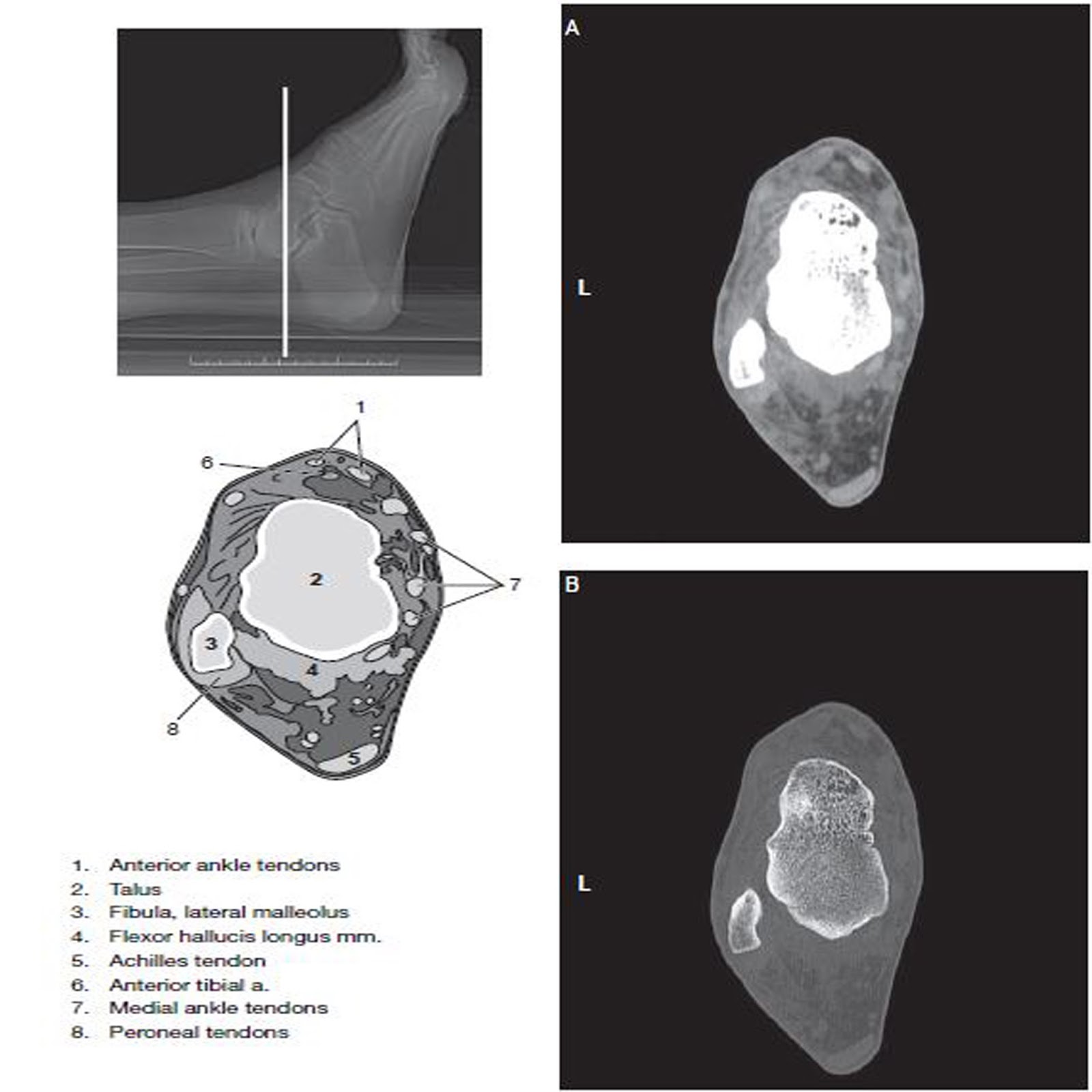 Ankle and Foot CT Imaging Technique RadTechOnDuty
