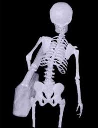 blog picture of x-ray of person carrying a bag leaning to one side