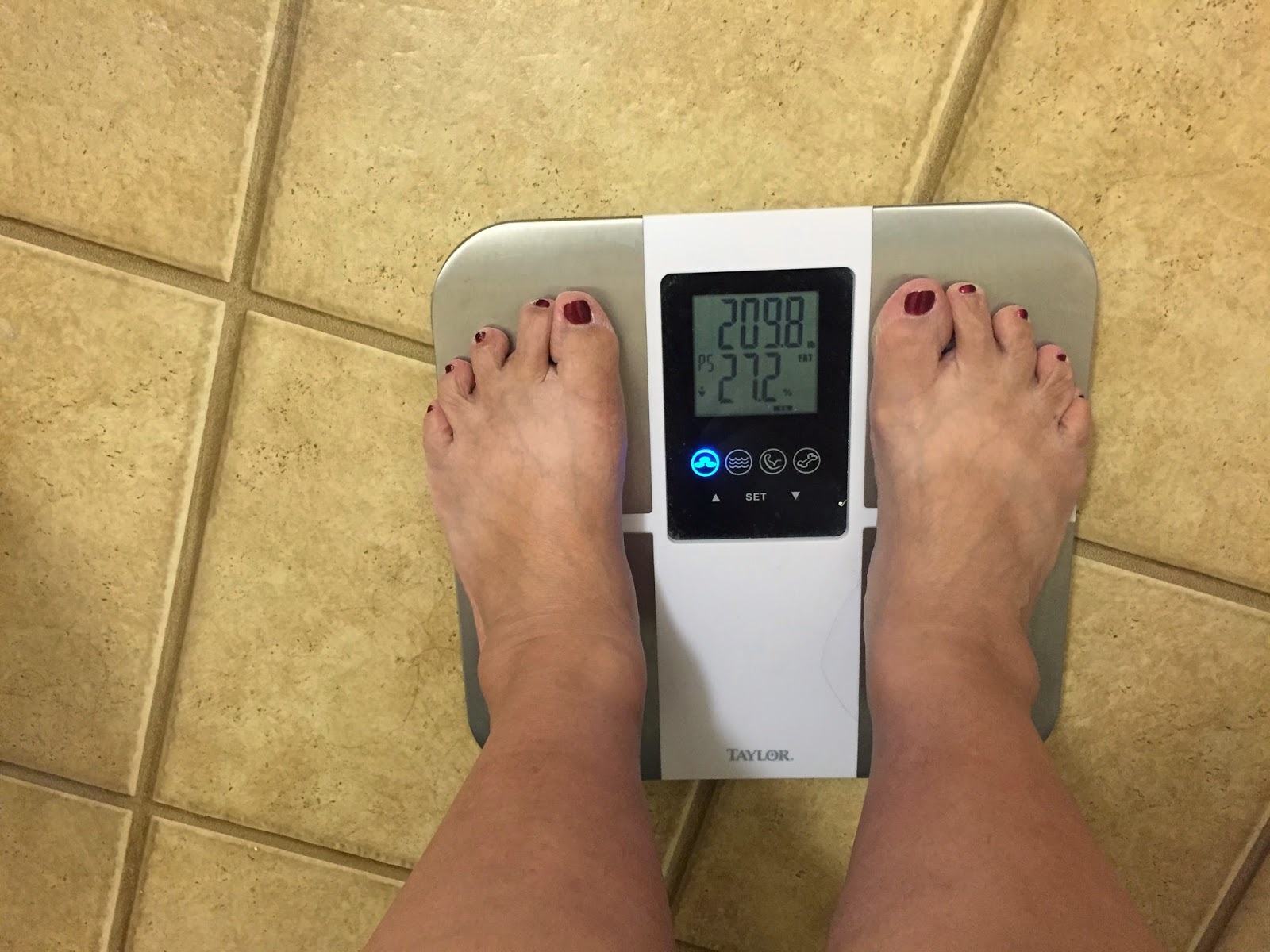 My Life before and after the Lap Band and Sleeve Surgery