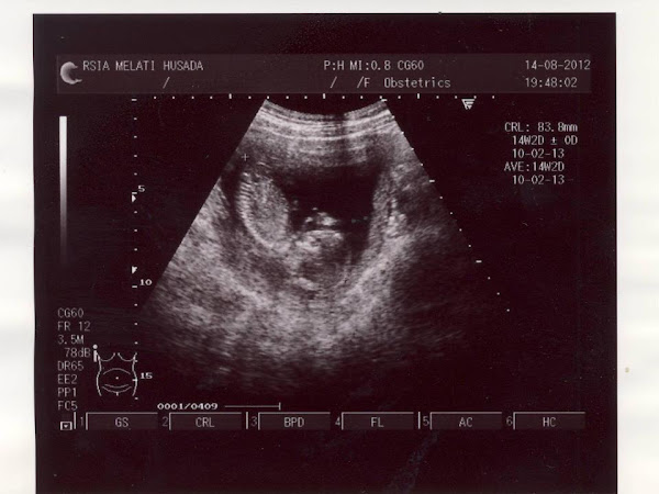 Baby Ai: Bulan Kedua di Rahim Mama