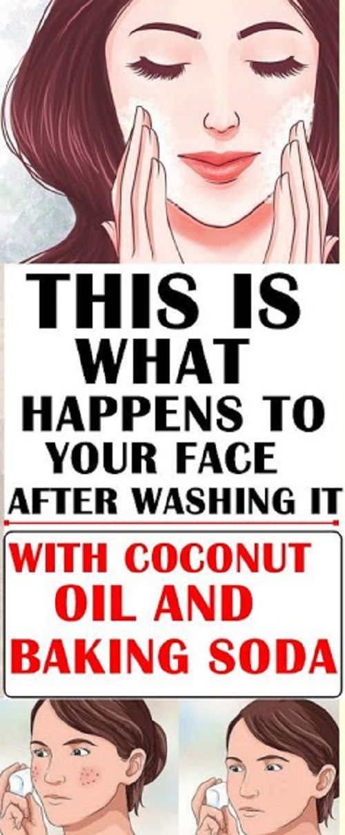 How to Use Baking Soda for Acne?