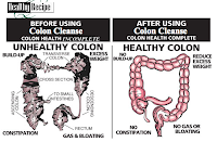 colon-cleanses-to-lose-weight