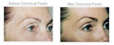 chemical-treatments.jpg chemical-treatments.jpg