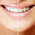 Tẩy trắng răng như thế nào hiệu quả nhất?
