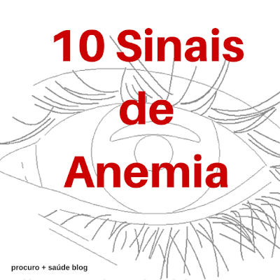 10 sinais e sintomas de anemia