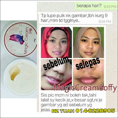 magic cream soffy buang tahi lalat ketuat kutil bintil minyak