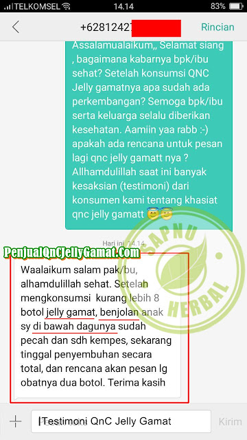 Cara Menyembuhkan Rahang Bawah Telinga Sakit Dan Bengkak Sampai Tuntas ~ Testimoni QnC Jelly Gamat Cara Menyembuhkan Rahang Bawah Telinga Sakit Dan Bengkak Sampai Tuntas ~ Testimoni QnC Jelly Gamat