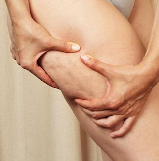 Tratamento para celulite, massagem e drenagem linfática Tratamento para celulite, massagem e drenagem linfática