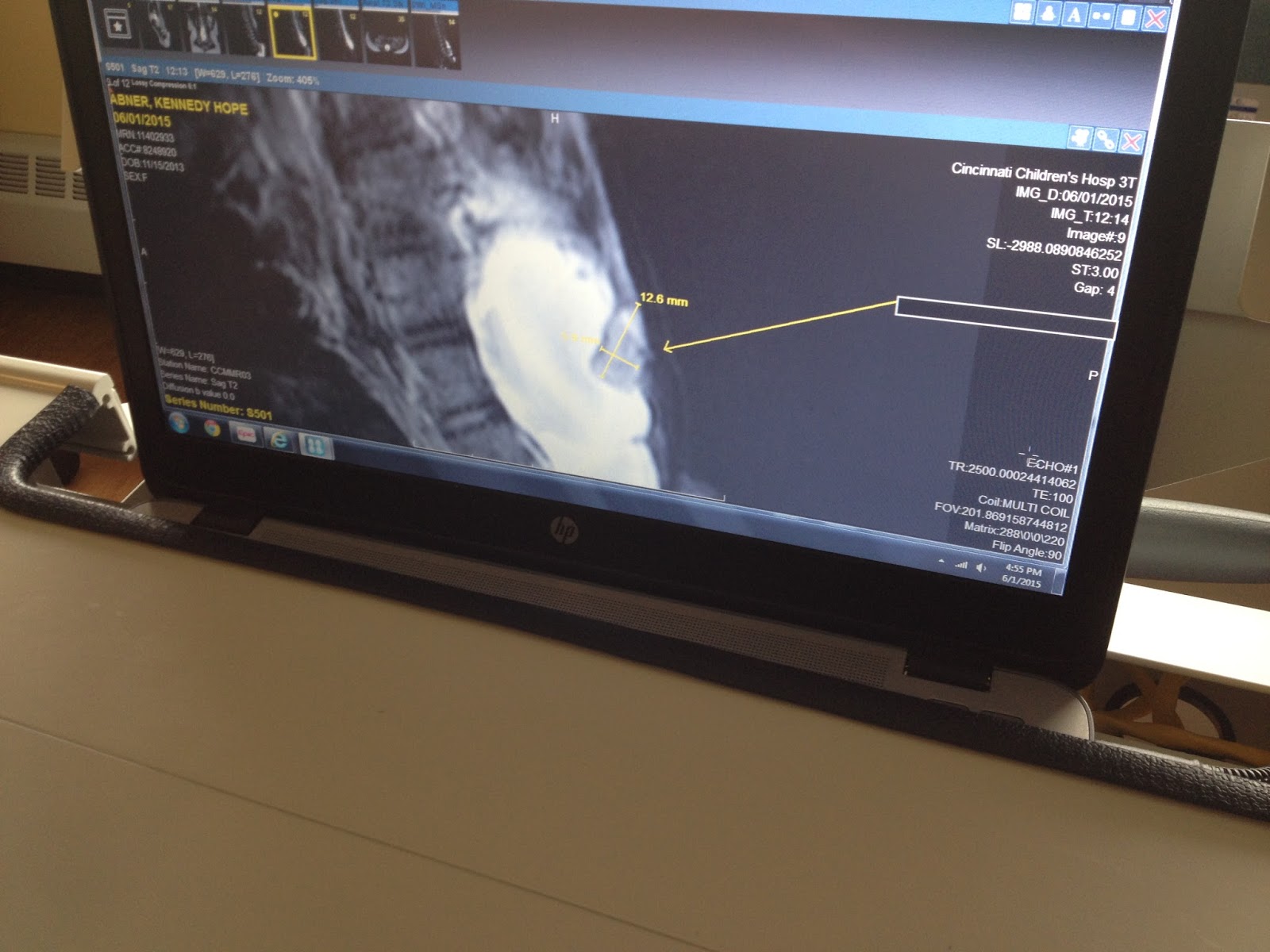 Sedated MRI Results