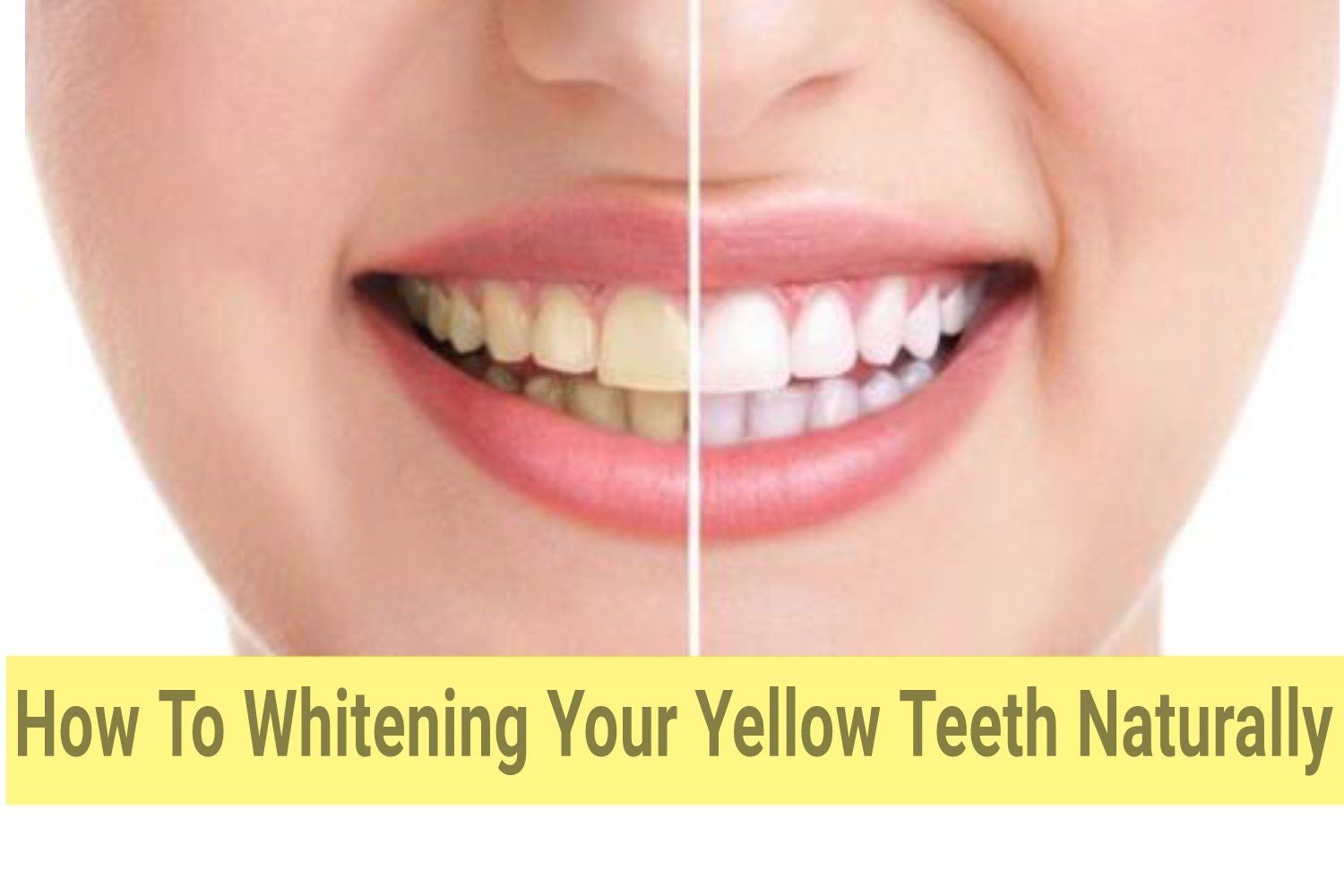 HOW TO WHITENING YOUR YELLOW TEETH NATURALLY Viralfeed7
